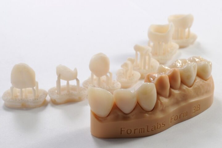 Boosting Patient Satisfaction with Dental Crown Printers