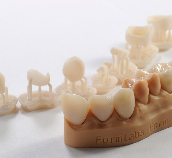 Boosting Patient Satisfaction with Dental Crown Printers